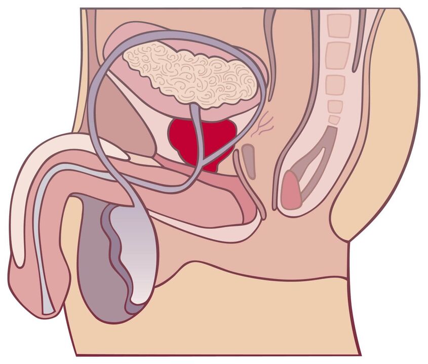 It's all about prostatitis